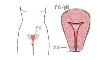 子宫内膜病变