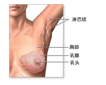早期乳腺癌的检查方