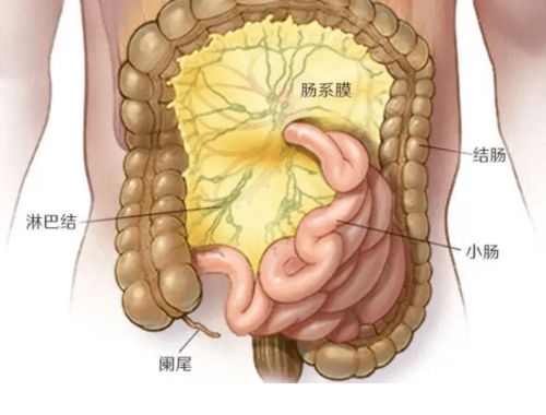 肠系膜淋巴结炎手术